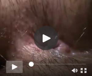 Anal Porno vom 2018-04-20 - Anal fingering