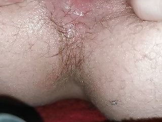 Close up to prolapse anus...