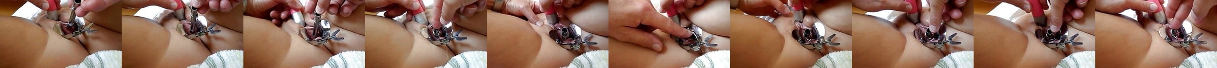 Catheter Porn Videos Tube Insertion Fetish Xhamster 