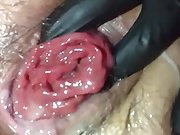 Gape