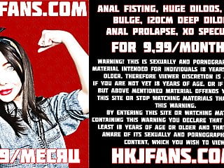 Fisting prolapse and hkjfans...