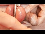 Tapping insterstial fluid