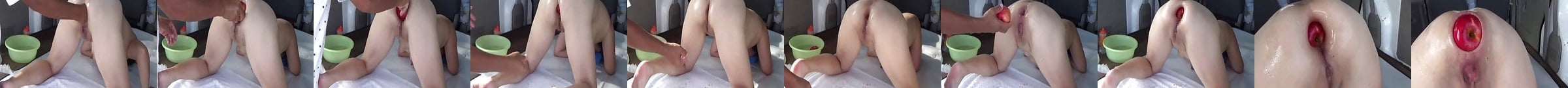 Xxxl Anal Speculum Gaping And Milk Enema Porn 1a Xhamster Pt