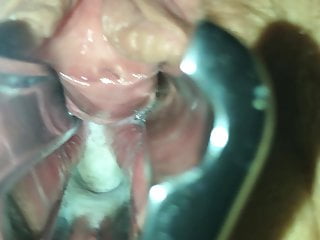 Gf trying with speculum opening pussy...