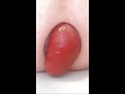 My small prolapse