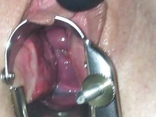 Cervix Speculum, Pussy, Speculum, Playing