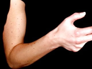 sexy fleckles arm