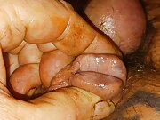Inflated Badder with Pissing and Needle in Cock Gland Inflation Pain  That Is Pleasure Bisexual Male.