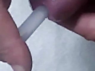 Insertion bulb and glue stick in to urethra